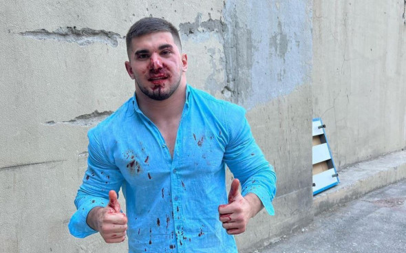 Чеченского блогера Асхаба Тамаева избили за неправильную парковку