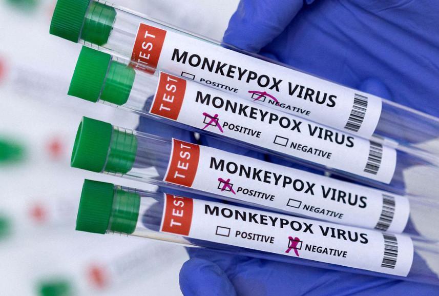 Министерство здравоохранения Украины подтвердило первый случай вируса оспы обезьян